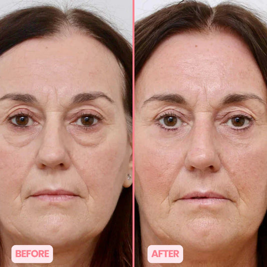 Płatki pod oczy MicroGlow 